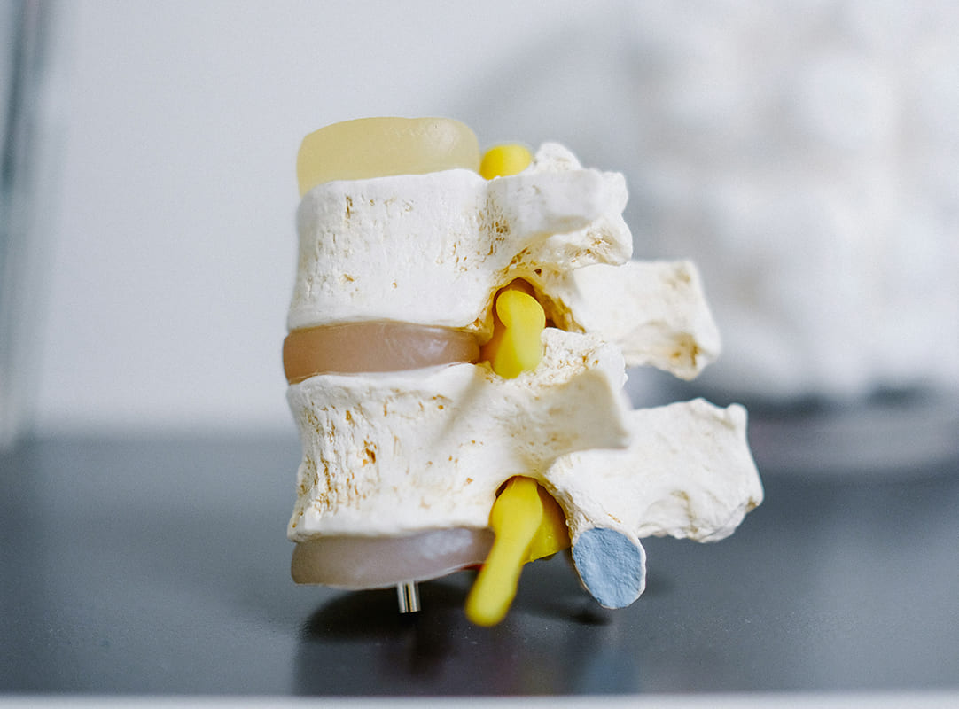 maccari terapie dolore